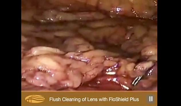 Flo-X Lens Cleaning System