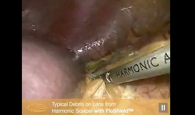 Deflection of Debris on Lens